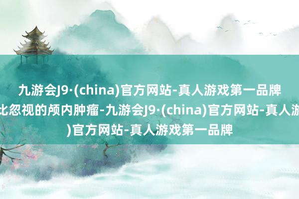 九游会J9·(china)官方网站-真人游戏第一品牌这是一种相比忽视的颅内肿瘤-九游会J9·(china)官方网站-真人游戏第一品牌